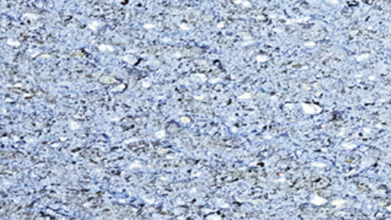 gris galva 644