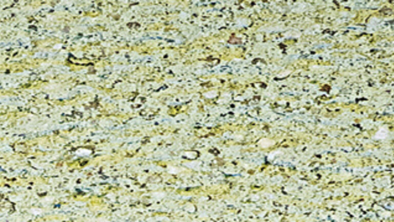 jaune lichen 863